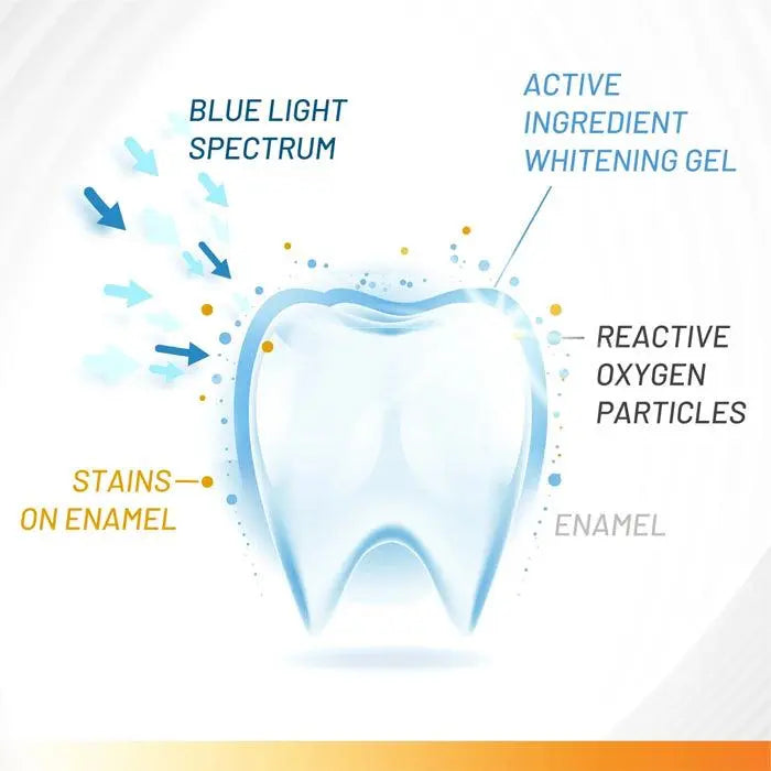 White Glo Accelerator Teeth Whitening Kit - XDaySale