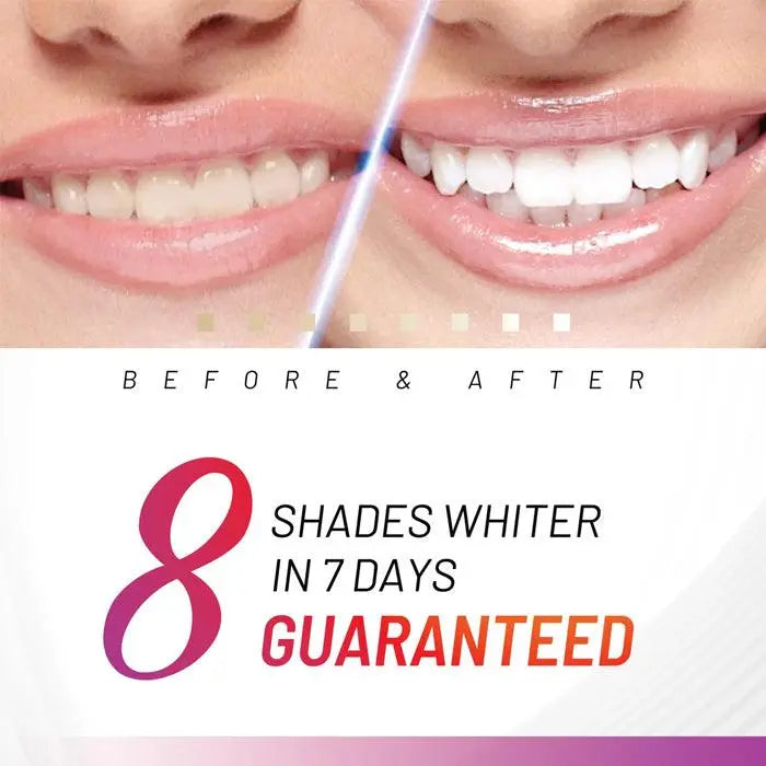 White Glo Accelerator Teeth Whitening Kit - XDaySale